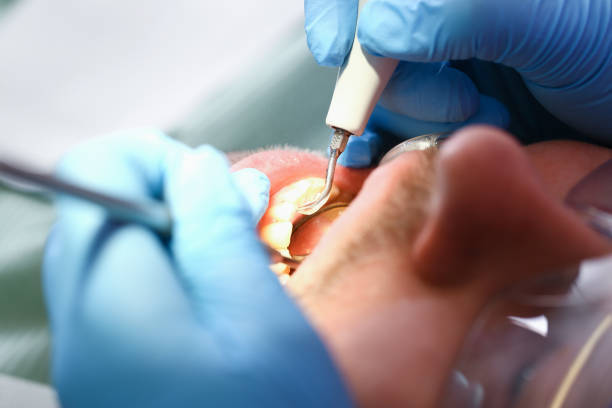 Best Emergency Dental Care for Sports Injuries in Waikoloa Village, HI