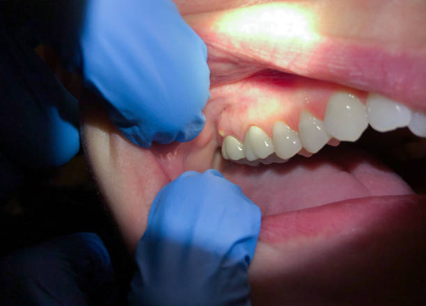 Best Emergency Treatment for Jaw Pain or Injury in Waikoloa Village, HI